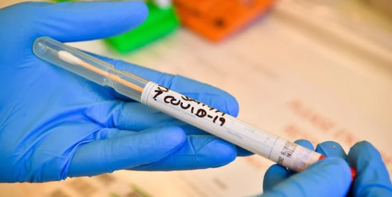 МОЗ уже радять негайно переймати досвід Чернівецької області в боротьбі з коронавірусом