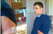Учасник АТО з Чернівців потребує грошей на операцію сину