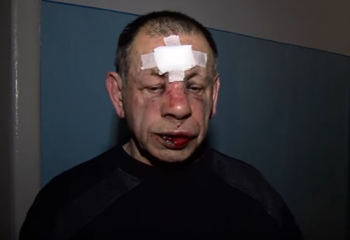 У Чернівцях жорстоко побили активіста Геннадія Гекова (відео)