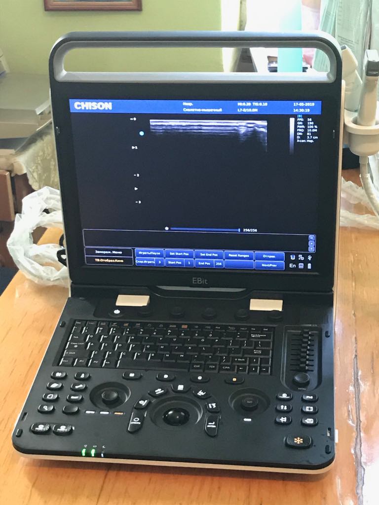 Небайдужі українці подарували Чернівецькій обласній дитячій лікарні сучасну ультрадіагностику