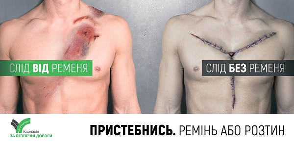 Ремінь або розтин: у Чернівцях розмістили  шокуючу соціальну рекламу