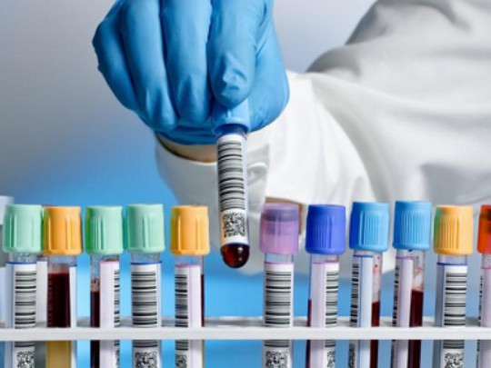 Скалецька розповіла, чому у Чернівцях немає тест-систем для виявлення коронавірусу