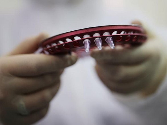 Чернівецька область отримала 600 комплектів захисту для лікарів від ВООЗ