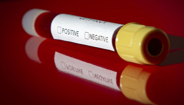 У світі одужали майже 83 тисячі осіб, заражених коронавірусом