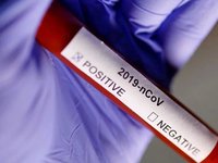 У Чернівецькій області найвищий в Україні показник захворюваності на коронавірус: до послаблення карантину готова лише одна область