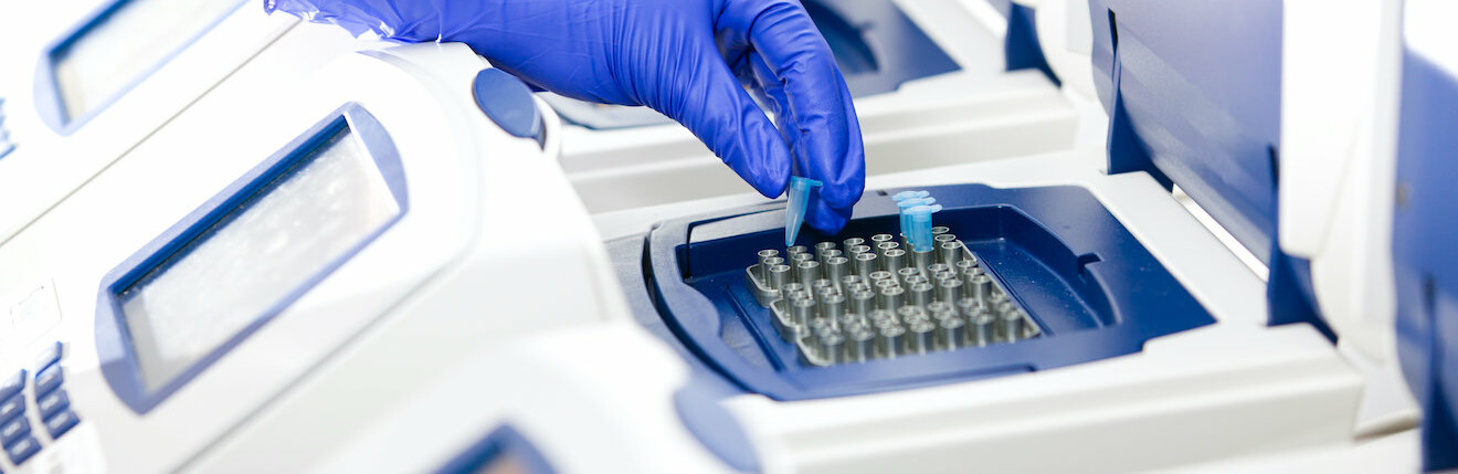 Київ та Чернівці утримують лідерство в Україні за кількістю ПЛР-тестувань на коронавірус 