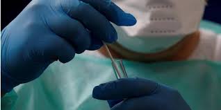 Наша система тестування - це як міряти температуру термометром у якого максимальна позначка 37,5: тестів треба проводити десь у 6 разів більше, - експерт