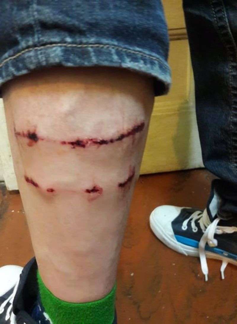 На художника Анатолія Федірка у центрі Чернівців напала зграя безпритульних собак 