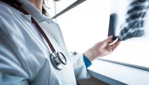 У Чернівецькій області тільки за серпень виявлено 17 нових хворих на туберкульоз