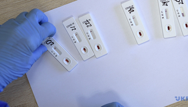 Чернівецька область отримала 1 006 упаковок з експрес-тестами по 25 у кожній  пачці