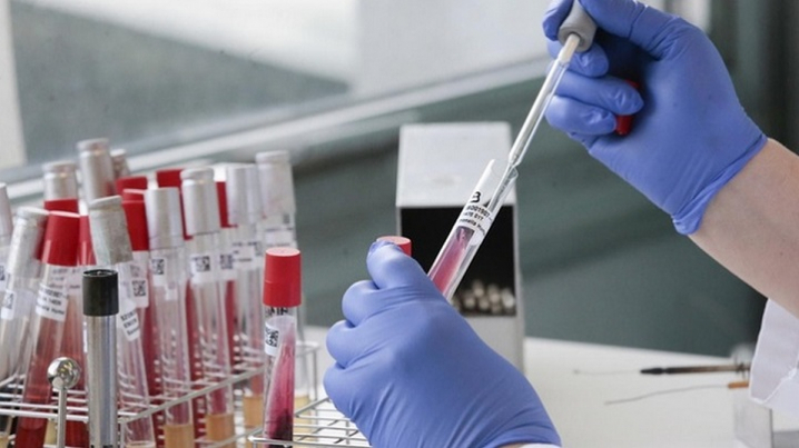 COVID-19: у Чернівцях різко зросла захворюваність